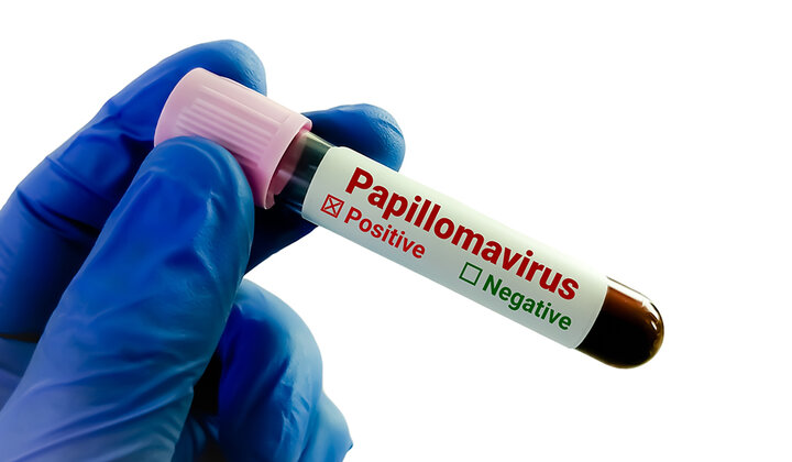 Kennistekort over HPV binnen de mondzorg