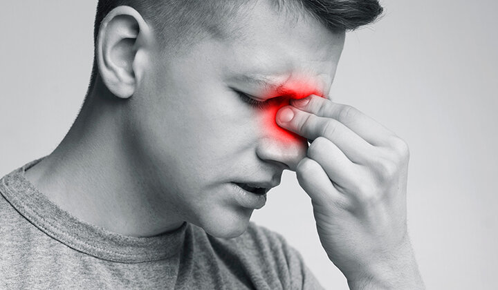 Helft sinusitisgevallen verklaard door odontogeen probleem