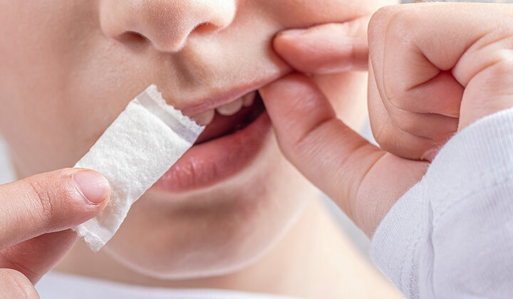 Zweedse nicotinezakjes veroorzaken slijmvlieslaesies in de mond