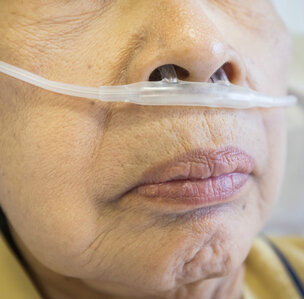 Screenen spoort COPD op, maar wijzigt beleid niet 