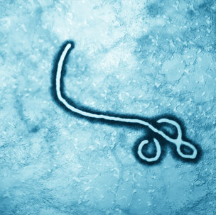 Mondzorgprofessionals en ebola 