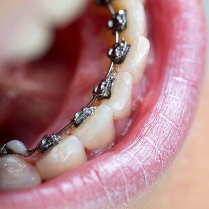 Fout titelgebruik orthodontie wordt beboet