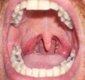 Geslachtsziekten en mond- en keelaandoeningen