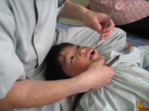 Heupfracturen en gebitsverlies bij mannelijke Japanse tandartsen
